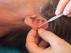 Formation en réflexologie auriculaire
